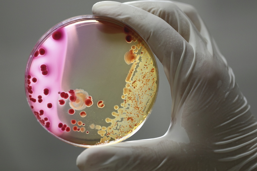 Bakterien in der Petrieschale